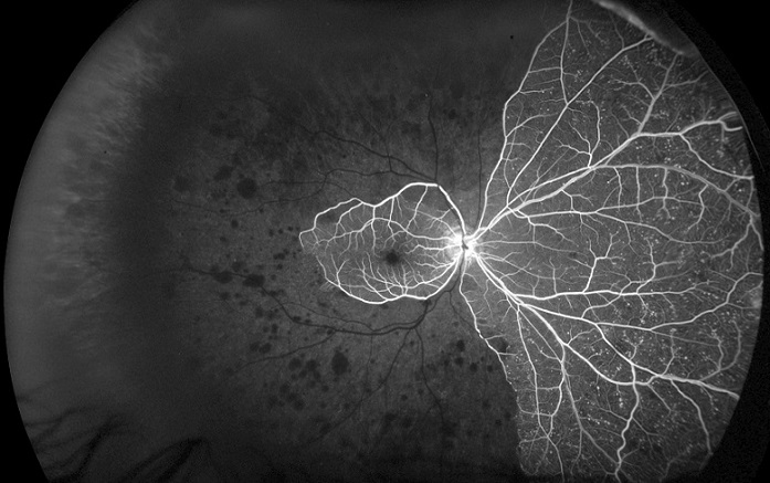 Optomap FA